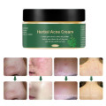 OEM Custom Herbal Acne Scar Removal Brightening Cream